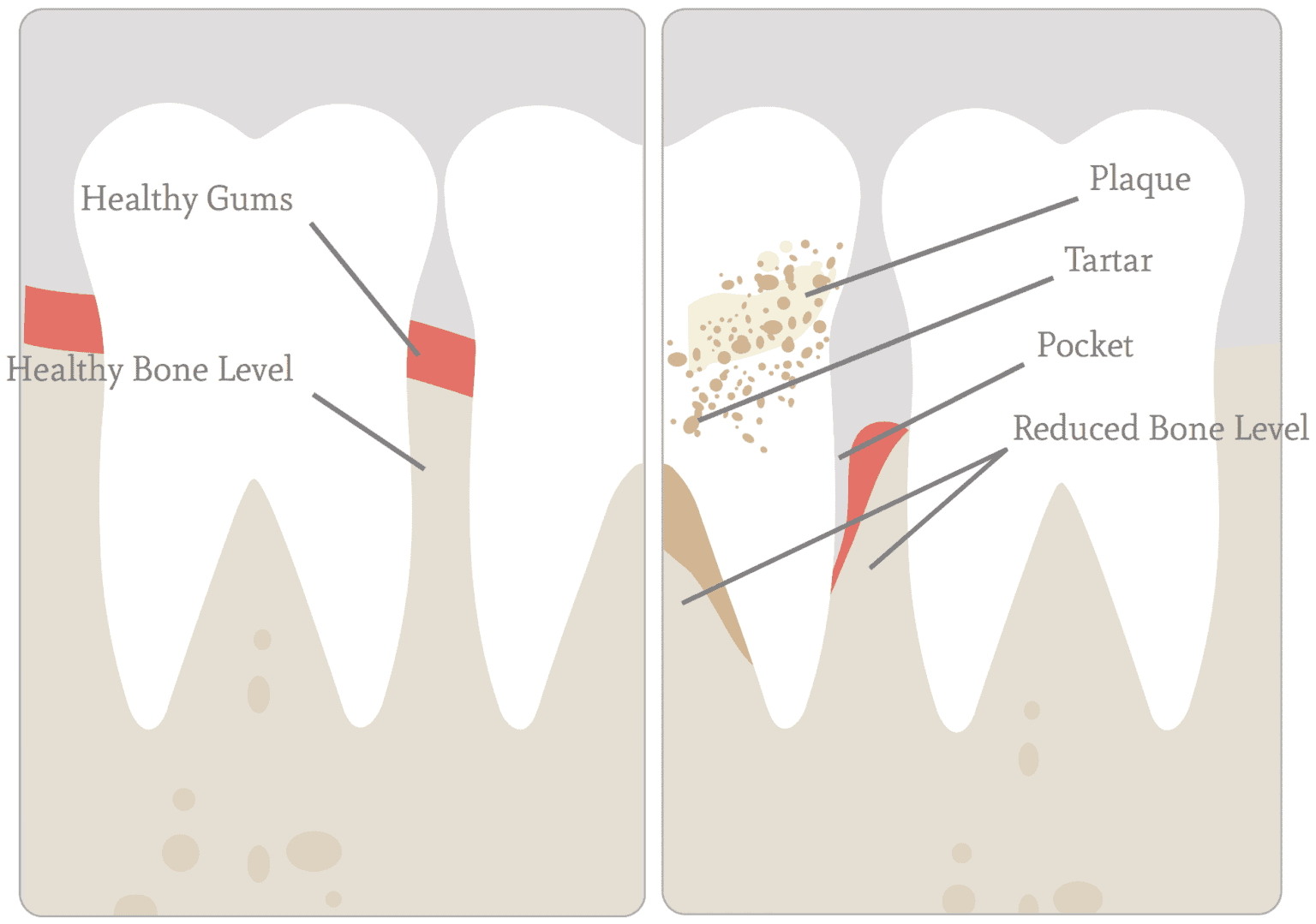 Gum Disease Dentist in The Woodlands Tx | Carrie Muzny, DDS