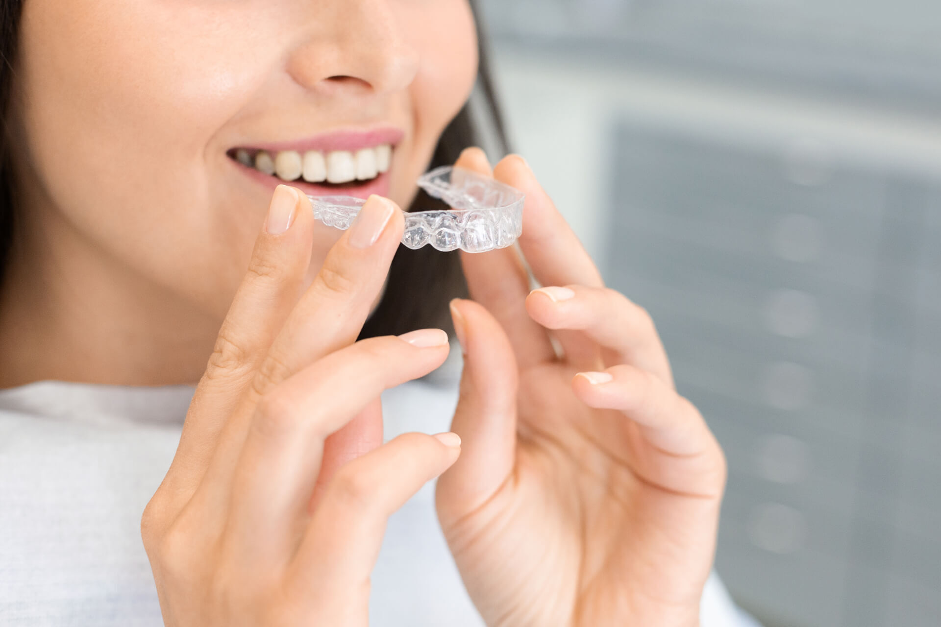 Clear Braces And Aligners: Benefits of Clear Braces - PerkinsOrtho