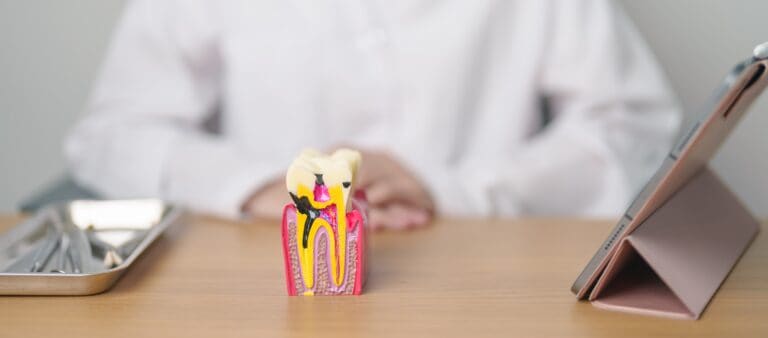 choosing the right dentist for a root canal treament